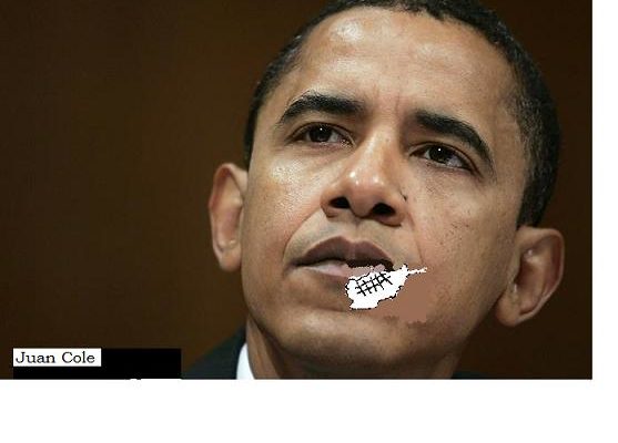 Political Cartoon: Obama’s Stitches