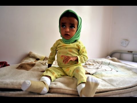 War-Torn Yemen faces Disease Outbreaks w/out Humanitarian Corridor