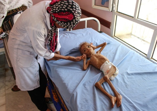 Five Million Children Risk Famine in Saudi-led War on Yemen