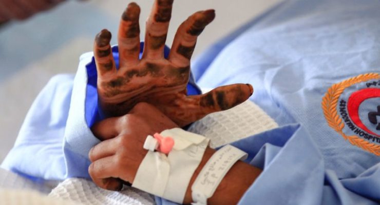 Saudi-Led Bombardment of Yemen kills 22, including Children, wounds 30